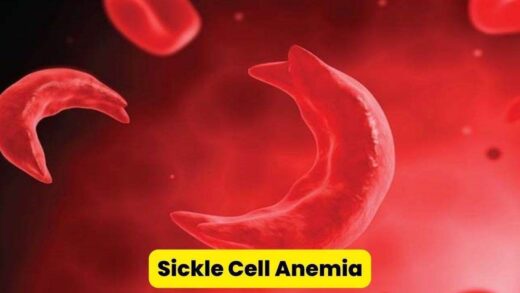 Sickle Cell Anemia: इंदौर में सिकलसेल जांच के लिए मालीक्यूलर लैब का उद्घाटन करेंगे प्रधानमंत्री