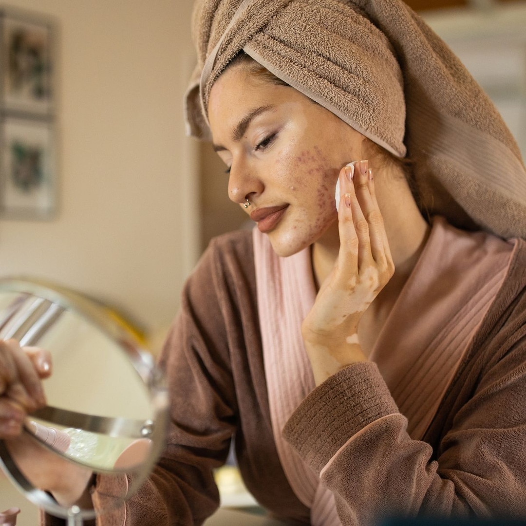 Airplane Acne Is Real—Here’s How Dermatologists Say To Treat It