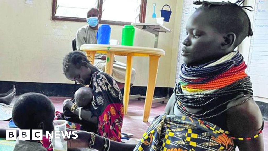 Malnutrition in Kenya’s Kakuma refugee camp after US aid cuts