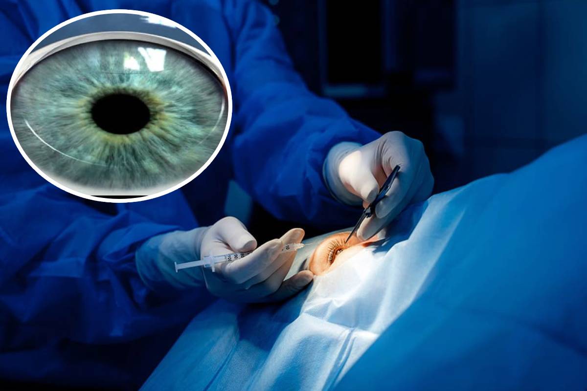 पहली बार 1 कॉर्निया से 2 जिंदगियों को मिली रोशनी, की गई ‘डीएमईके सर्जरी’ | eye transplant was successfully performed at the Cornea Transplant Centre of BMHRC.