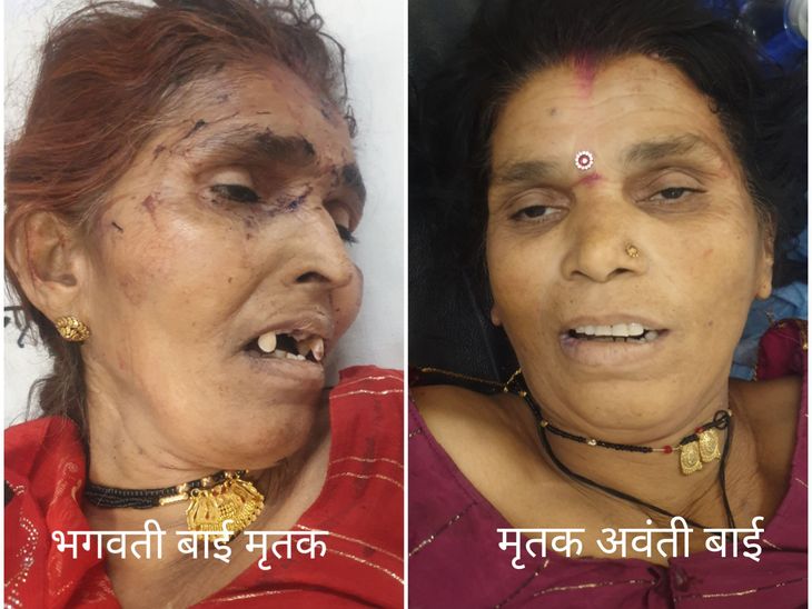 पचोर के पास सड़क हादसा, दो महिला की मौत:  पिकअप-ट्रक भिड़ंत में 20 घायल, 6 इंदौर रेफर; अस्पताल में घायलों का इलाज जारी – shajapur (MP) News