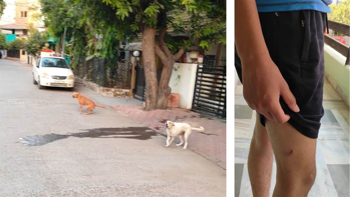 इंदौर में 18 वर्षीय युवक पर कुत्तों ने किया हमला; हुआ घायल, आसपास के लोगों ने बचाया