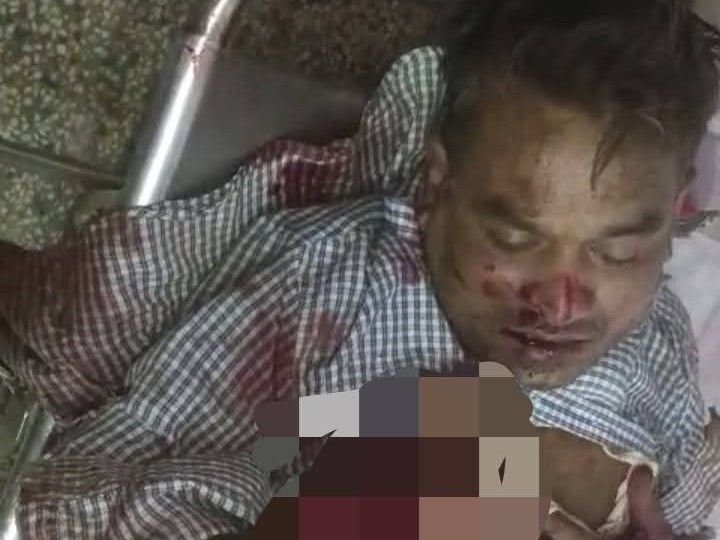 बाइक सवार डॉक्टर को वाहन ने मारी टक्कर: हाथ-पैर और सिर में गंभीर चोट, जिला अस्पताल में भर्ती; चालक फरार – Sidhi News बाइक सवार डॉक्टर को वाहन ने मारी टक्कर: हाथ-पैर और सिर में गंभीर चोट, जिला अस्पताल में भर्ती; चालक फरार – Sidhi News